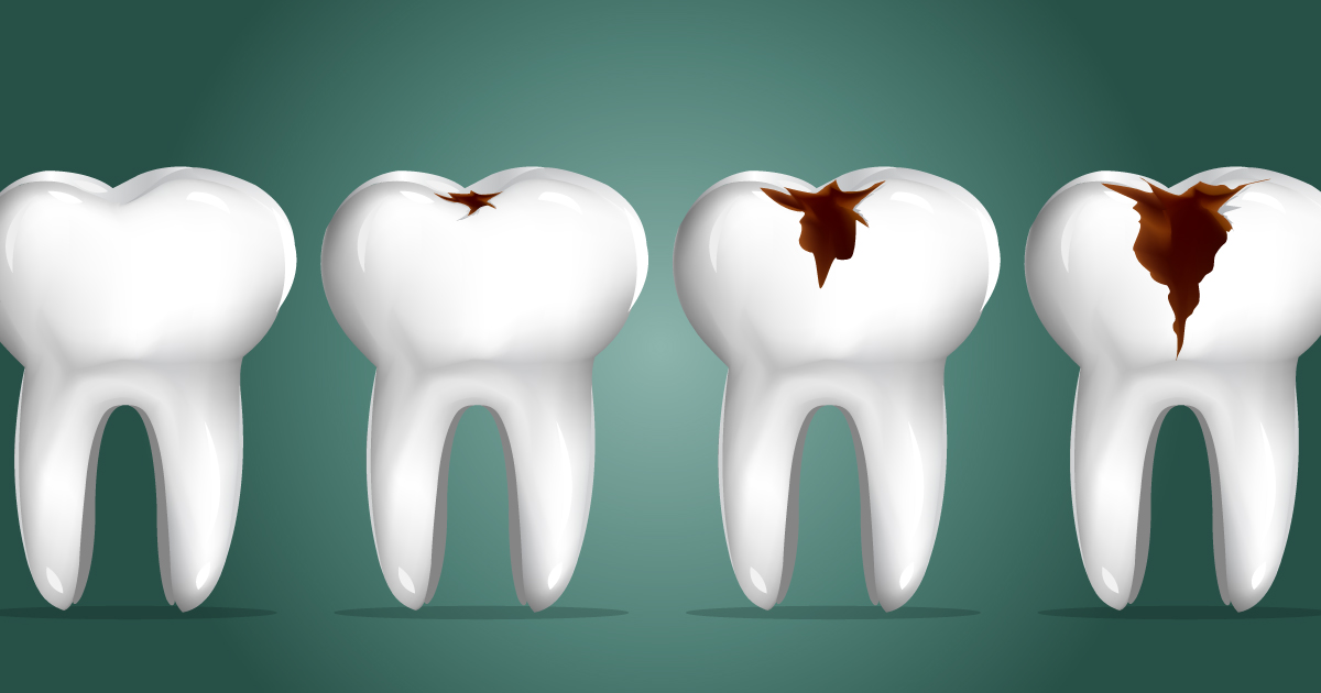 ms-blog_eating-disorders-and-dental-health
